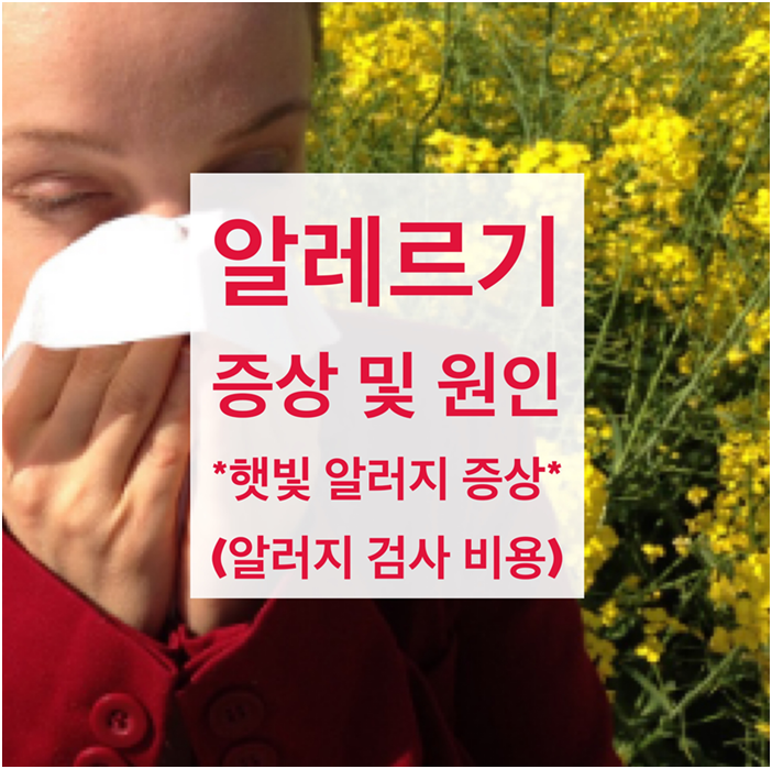 알레르기 증상 및 원인 6가지 (햇빛알러지, 알레르기 검사, 알러지/알레르기 검사 비용)